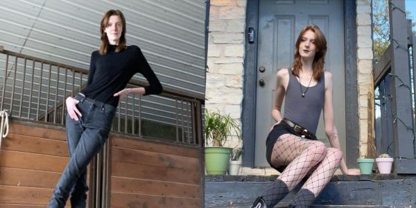 世界上腿最长的女人在被喷子攻击后发声